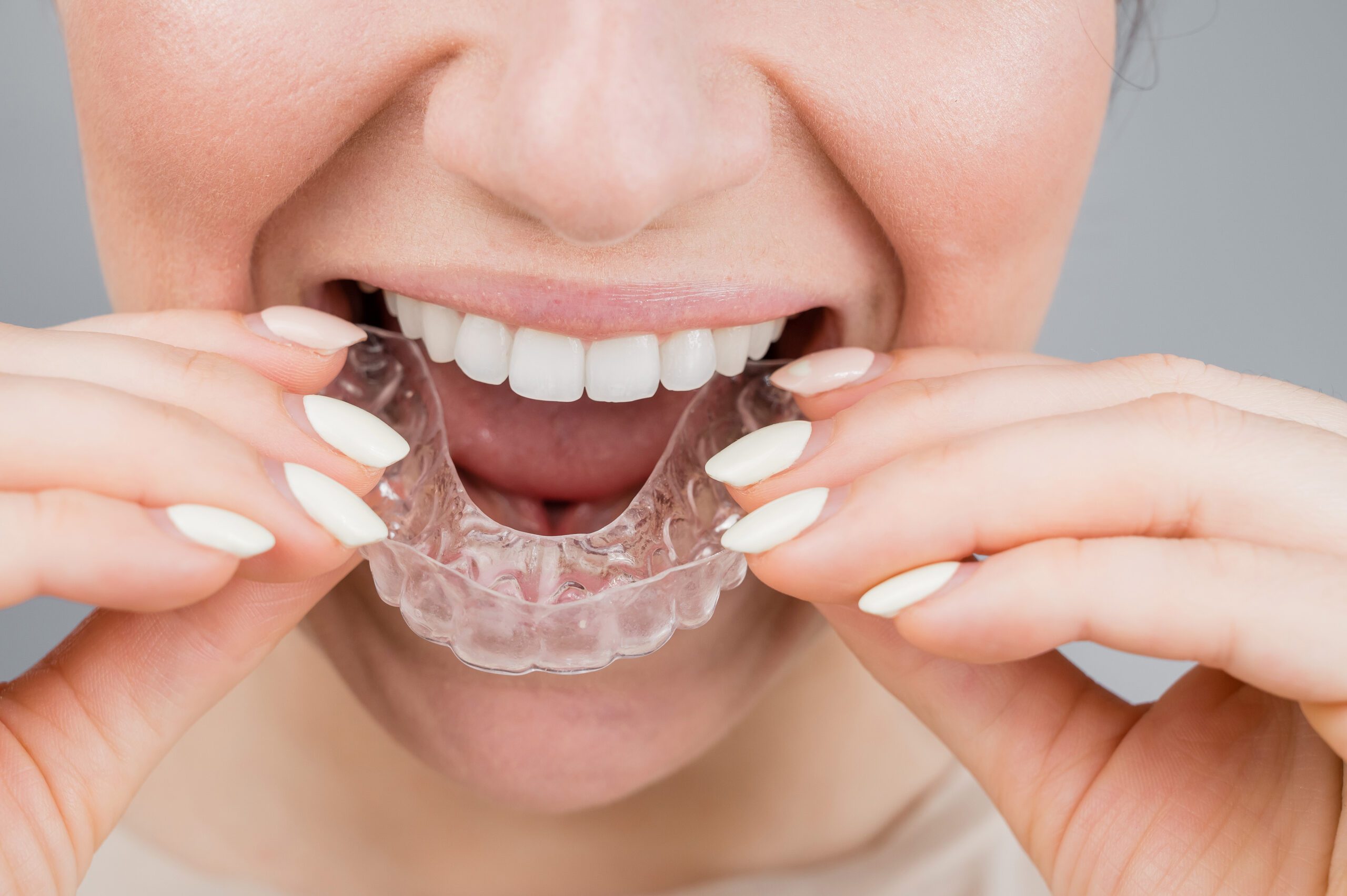 orthodontist in West New York